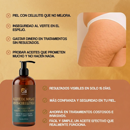 Aceite Anticelulítico Reafirmante Serena™